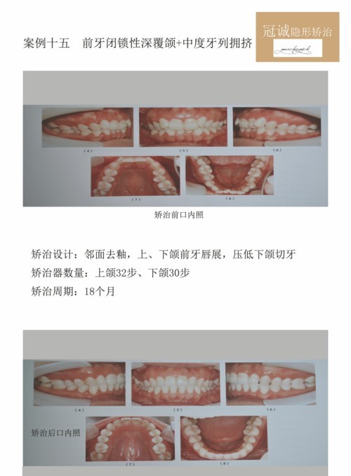 015ǰ+жӵ_1.jpg