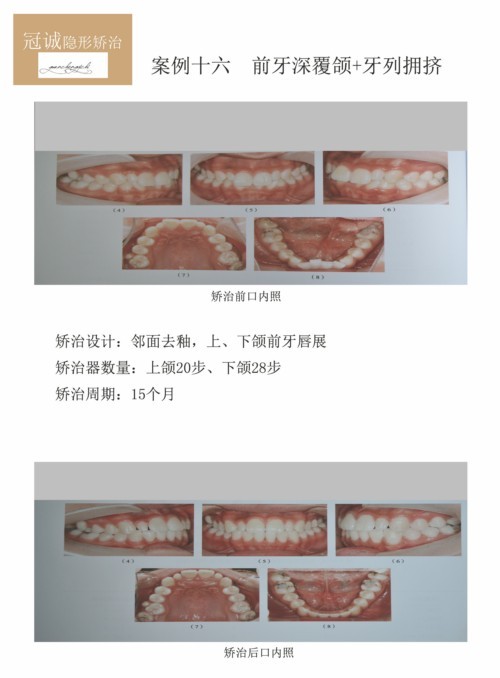 016ǰ+ӵ_1.jpg